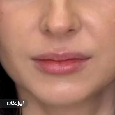 کلینیک زیبایی دکتر زهرا اصفهانی آتش بیگ