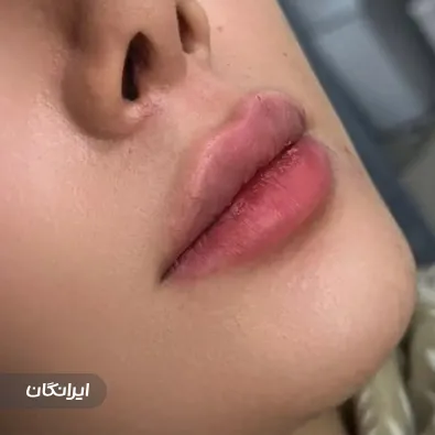 کلینیک زیبایی سایا