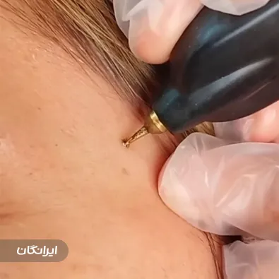 کلینیک زیبایی سایا