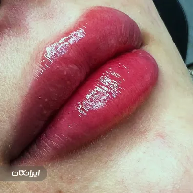 کلینیک زیبایی درتا