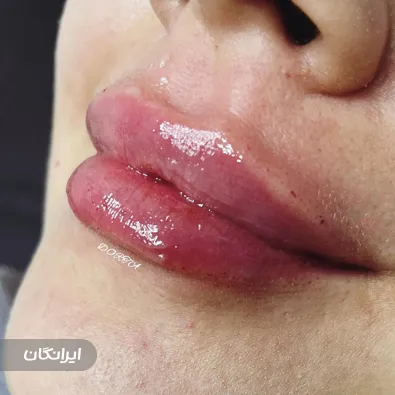 کلینیک زیبایی درتا