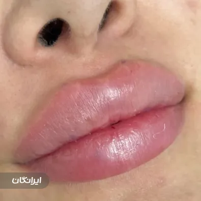 کلینیک زیبایی درتا