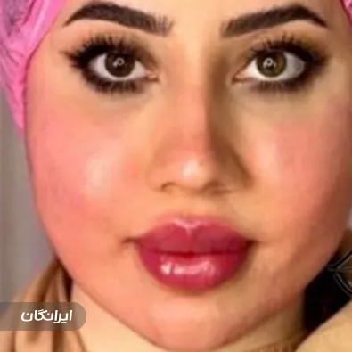 کلینیک زیبایی مرمر