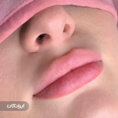 کلینیک زیبایی مرمر