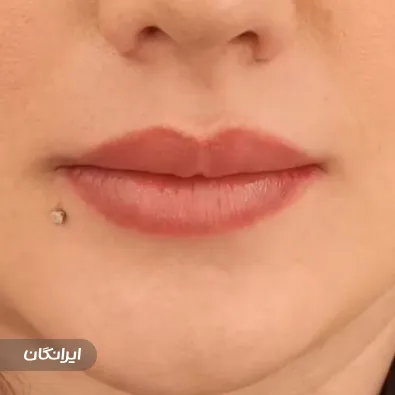 کلینیک زیبایی دکتر پژمان اکبری