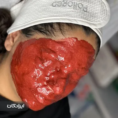 مرکز لیزر ونوش