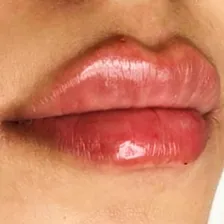 کلینیک زیبایی آترینا