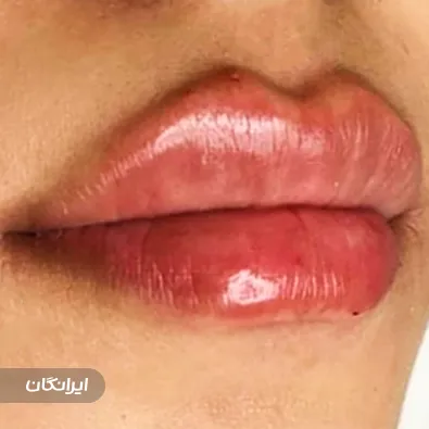 کلینیک زیبایی آترینا