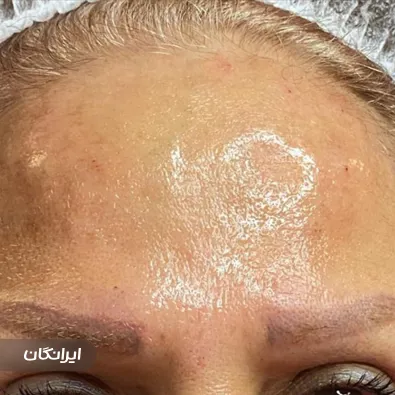 کلینیک زیبایی آترینا