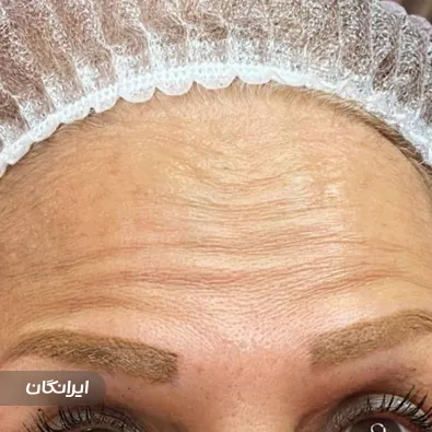 کلینیک زیبایی آترینا