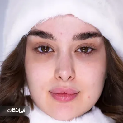 سالن زیبایی زهره طیبی