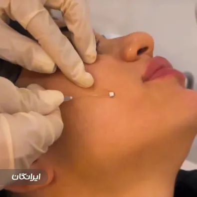 کلینیک زیبایی دکتر پونه حیدری