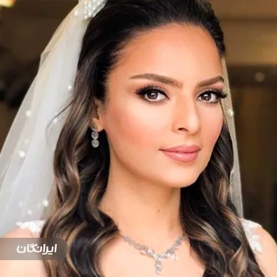 هیرکالریست رویا نوری