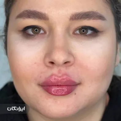 کلینیک زیبایی مهرزاد