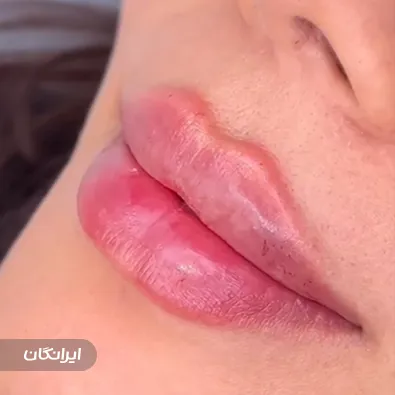 کلینیک زیبایی آرمان