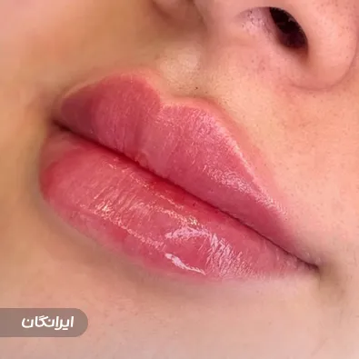 کلینیک زیبایی آرمان