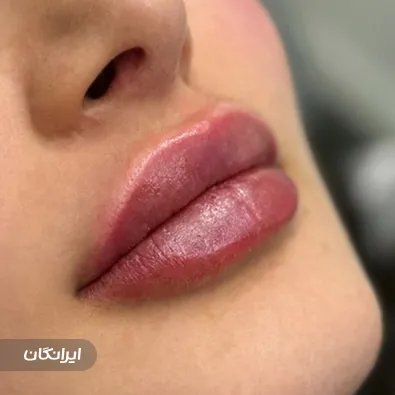 کلینیک زیبایی آرمان