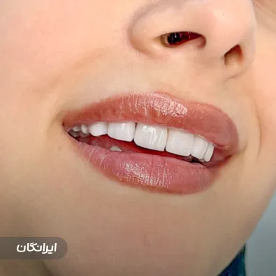 دکتر سیاوش حاتمی