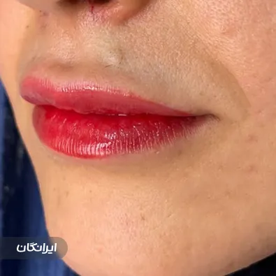 کلینیک زیبایی دکتر عصمت باریک بین