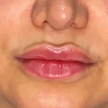 کلینیک زیبایی دکتر عصمت باریک بین