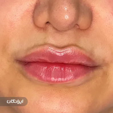 کلینیک زیبایی دکتر عصمت باریک بین