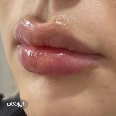 کلینیک زیبایی دکتر عصمت باریک بین