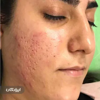 کلینیک زیبایی 100