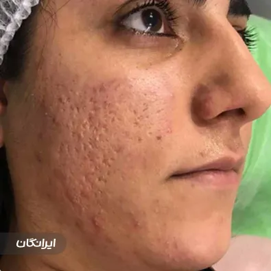 کلینیک زیبایی 100