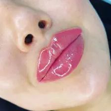 کلینیک زیبایی نفس بیوتی