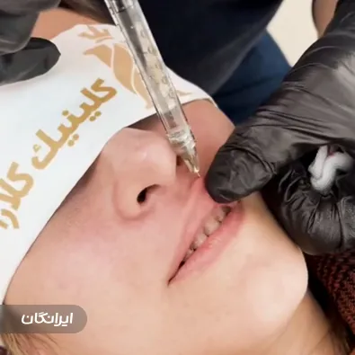 کلینیک زیبایی کلارا