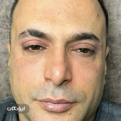 سالن آرایش دائم رضا شیرپور