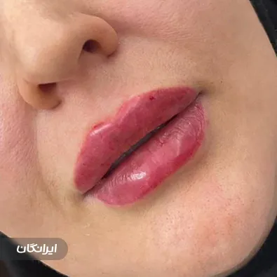 کلینیک زیبایی مای درما