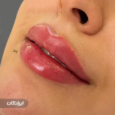 کلینیک زیبایی مای درما