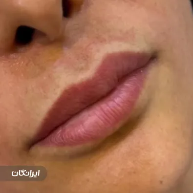 کلینیک زیبایی آرارز