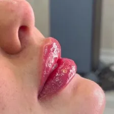 کلینیک زیبایی آرارز