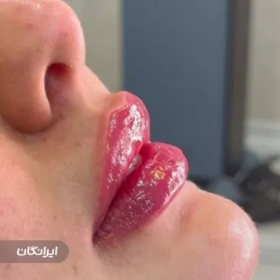 کلینیک زیبایی آرارز