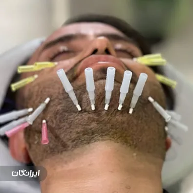 کلینیک زیبایی آنجل