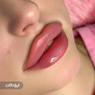 کلینیک زیبایی ایپک