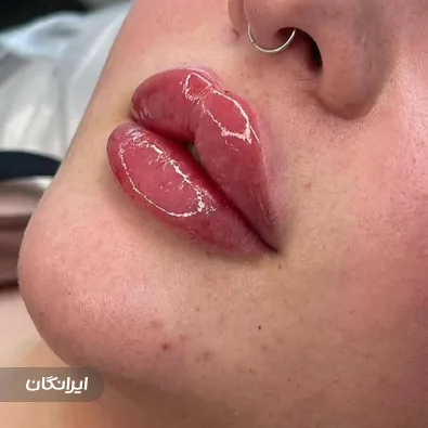 کلینیک زیبایی ایپک