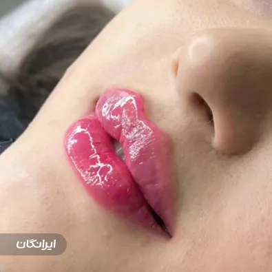 کلینیک زیبایی دکتر الناز ولیزاده درخشان