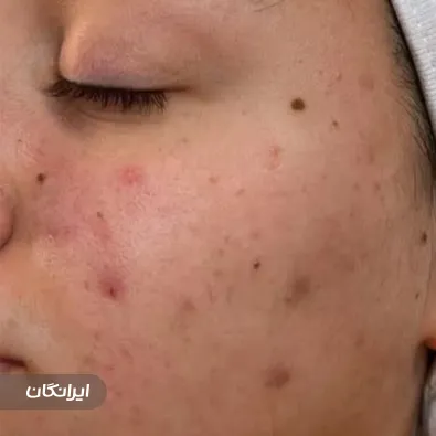 کلینیک زیبایی آذر اسکین