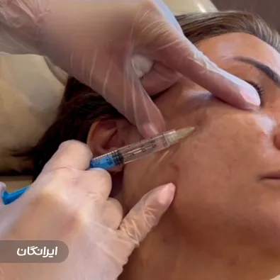 مرکز لیزر و زیبایی ایرانا