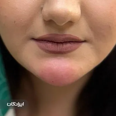 کلینیک زیبایی فریماه