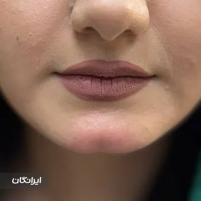 کلینیک زیبایی فریماه