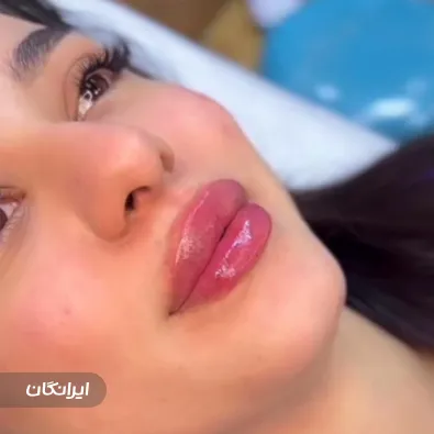 کلینیک زیبایی گلد اسکین