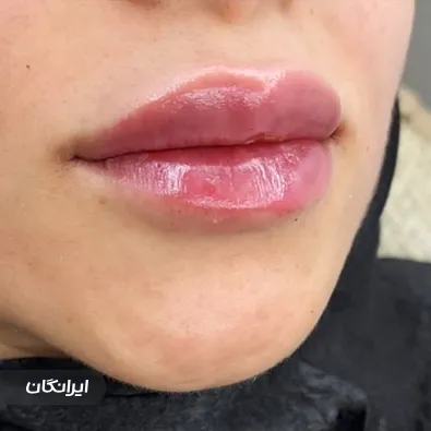 کلینیک زیبایی دکتر شکوفه بهرامی