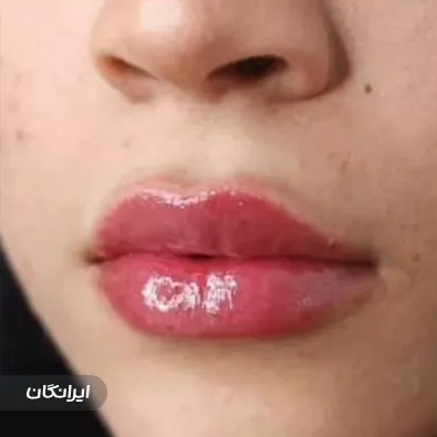 کلینیک زیبایی دکتر شکوفه بهرامی