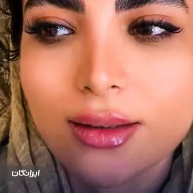 کلینیک زیبایی دکتر شکوفه بهرامی