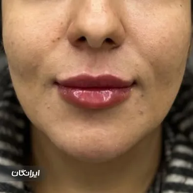 کلینیک زیبایی دکتر مهسا حاجی زاده