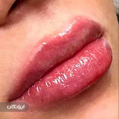 کلینیک زیبایی دکتر مهسا حاجی زاده